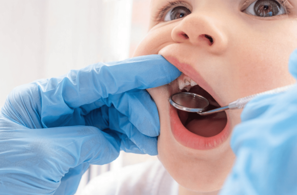 A dentist is checking an infant for cavities.