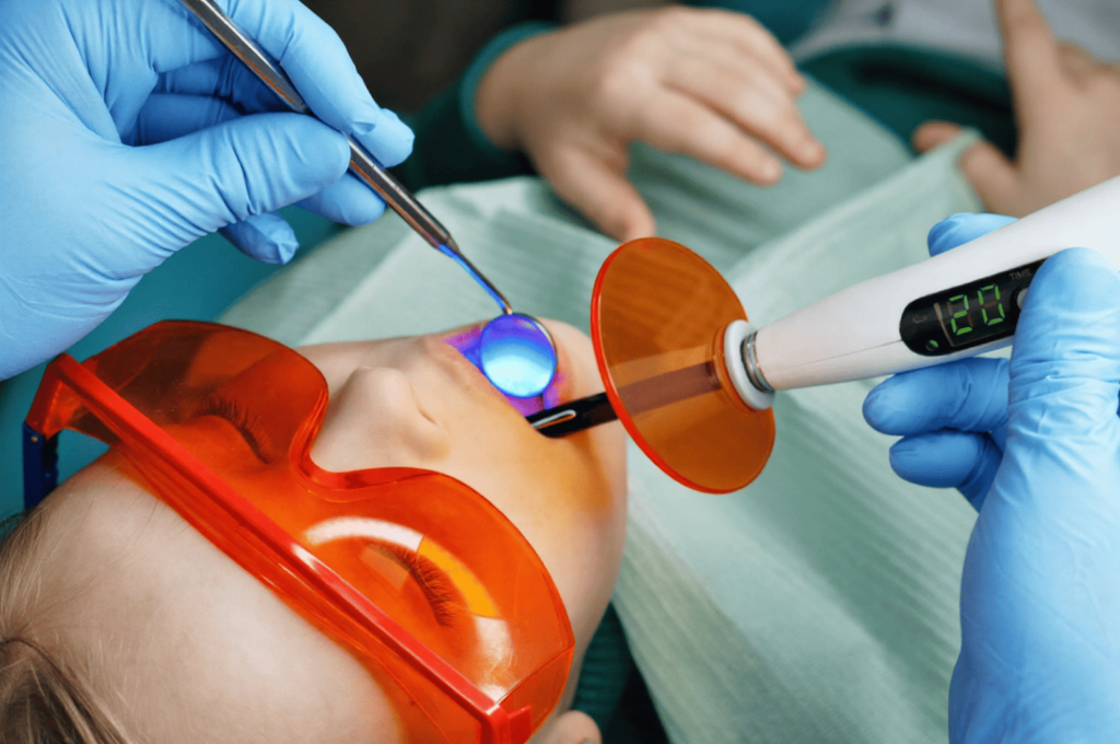 A young girl is getting dental sealants applied using a curing light.