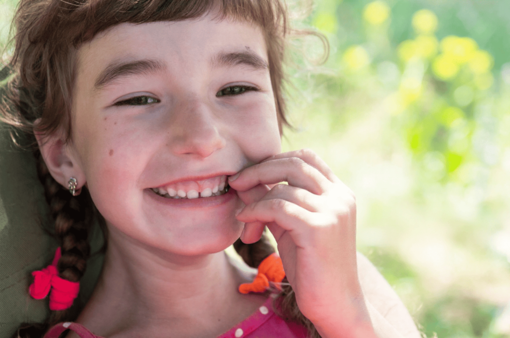 When Is Silver Diamine Fluoride Smart — and When Is a Filling the Better Fix?
