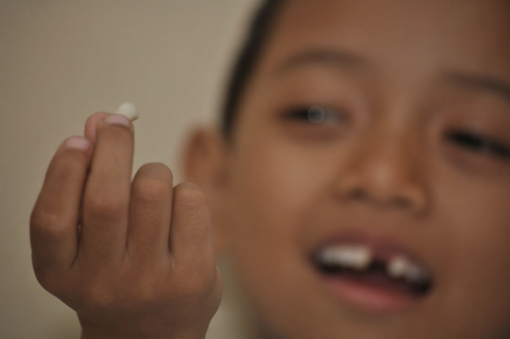 A young boy isn't too worried when his baby tooth gets knocked out.