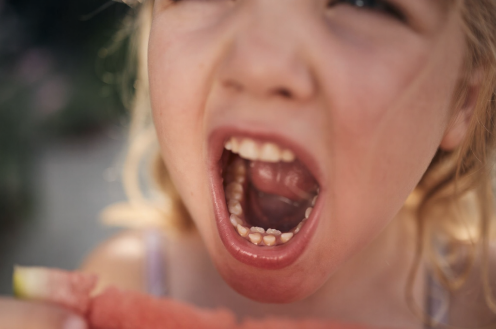 A young girl has two shark teeth at once.