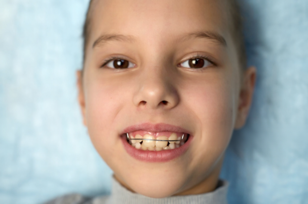 A young girl uses a space maintainer until her permanent tooth erupts.